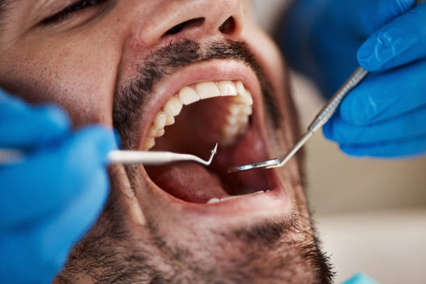 Best 24-Hour Emergency Dental Care in Lindsborg, KS